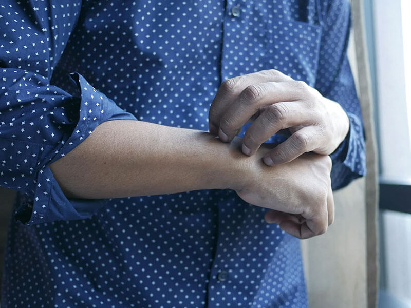 Homeopathie bij exceemklachten